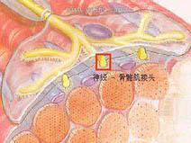 運動性骨骼肌微損傷機(jī)制的研究進(jìn)展