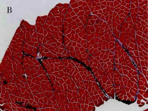 運動性骨骼肌微損傷的研究