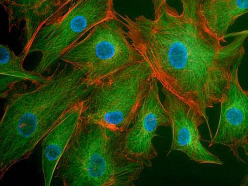 細(xì)胞骨架與運動損傷
